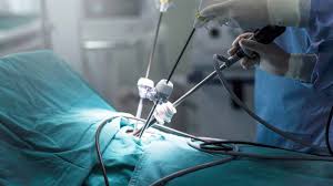 Laparoscopic Pancreas Surgery
